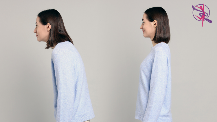 Duruş Bozukluklarında Fizyoterapi ile Kalıcı Çözümler